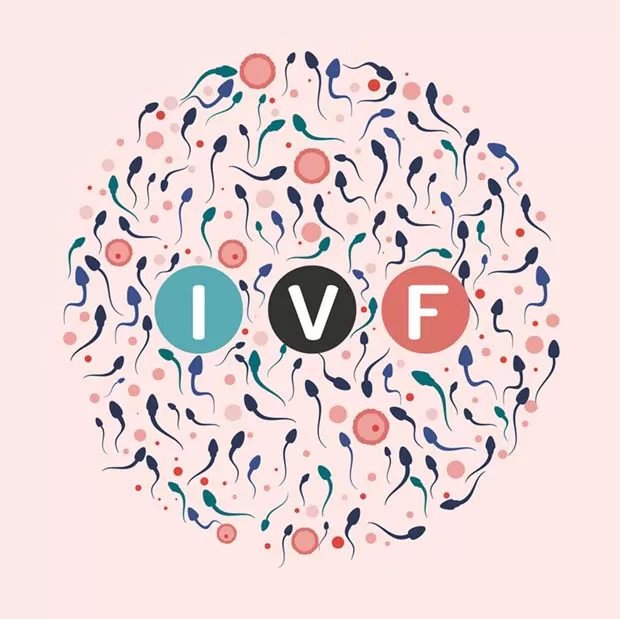 IVF Treatment